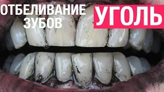 Как отбелить зубы в домашних условиях активированным углем