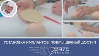 Установка имплантов. Подмышечный доступ