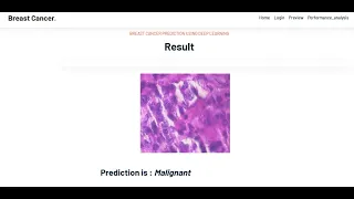 Breast Cancer Classification using CNN with Transfer Learning Models | Python IEEE Project 2023