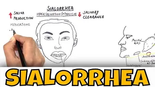 Sialorrhea / Drooling - Causes, Clinical features and Treatment