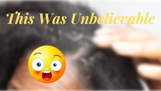 This Was The Worst | Unbelievable Scratching