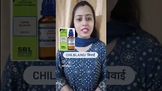 Chilblains Homeopathic medicine