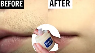 Remove Unwanted Hair Permanently| Vaseline Hair Removal | Hair Removal Naturally