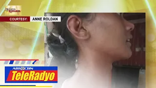 Goiter iniinda ng isang ina mula sa Antipolo City | Lingkod Kapamilya (21 Feb 2023)