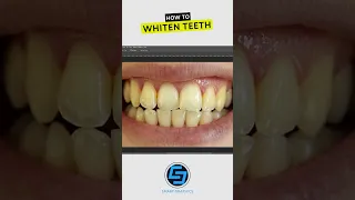 The best way to whiten teeth in photoshop tutorial