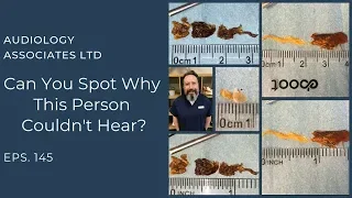 CAN YOU SPOT WHY THIS PERSON COULDN'T HEAR? - EP 145