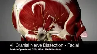 Facial Nerve dissection - Orofacial Pain Demystified.