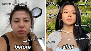 spending $1500 to not be ugly lol (EXTREME GLOW UP TRANSFORMATION)