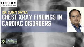 XRAY CHEST FINDINGS IN HEART DISEASE || DR SUMIT DATTA || ASD | VSD | TOF | MITRAL VALVE DISEASE