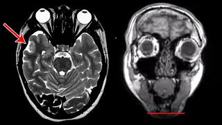 This Woman drank 3 gallons of water to win a nintendo wii Here’s what happened to her brain.