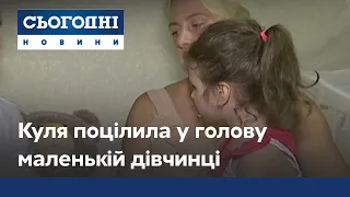 Куля у голову: дівчина поцілила з пневматичної гвинтівки у трирічну дівчинку