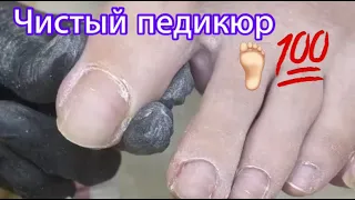 Чистый педикюр 🦶🏻💯👌