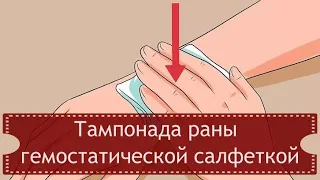 Тампонада раны гемостатической салфеткой