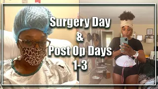 Video Title: Extended Tummy Tuck Surgery Day | Post Op Days 1-3 | Muscle Repair & Lipo