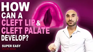 Cleft Lip vs Cleft Palate (Easy to Understand)
