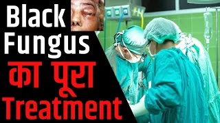 ऐसे होता है Black Fungus का इलाज | Mucromycosis Treatment in Hindi