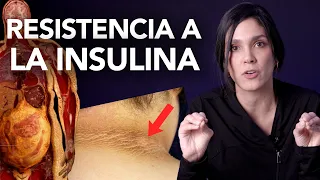 RESISTENCIA A LA INSULINA | ¿BAJAR DE PESO? - Dra. Jackie