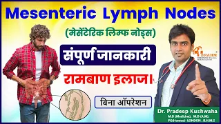 Mesenteric lymph nodes Treatment | adults | Without surgery | homeopathy| मेसेंटेरिक लिम्फैडेनाइटिस