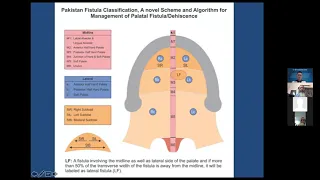 Sep. 19th. 2021 The International Craniofacial Chang Gung Webinar