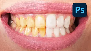 How To EASILY Whiten Teeth In Photoshop