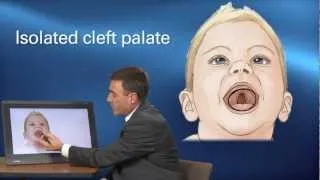 Cleft Treatment - Pediatric Playbook - Boston Children's Hospital