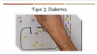 Coffee Break  - Session 25 (Diabetes Awareness)