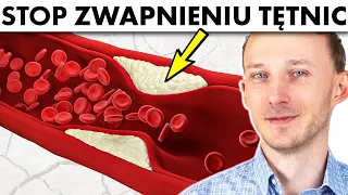 Wapń w tętnicach i mózgu (zwapnienie tętnic): 12 sposobów, jak temu zapobiec | Dr Bartek Kulczyński