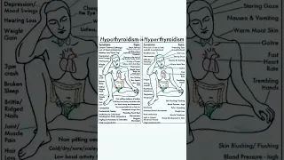 Hypothyroidism or Hyperthyroidism #short #viral #youtubeshorts