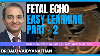 4 CHAMBER VIEW ANOMALIES OF THE RIGHT SIDE | Dr Balu Vaidyanathan #fetalecho2