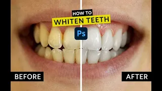 The best way to whiten teeth in Photoshop Tutorial  | Photoshop kaise sikhe