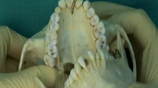 1.11 Step 7.  Nerves, vessels and foramina of the nasal cavity (skull)