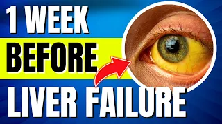 10 Liver Failure Symptoms (1 WEEK Before It's Too Late)