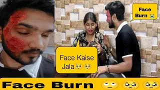 Prank On My Girlfriend !! Face Burn !! Gone Emotional 🥺 !! Ankush Rajput