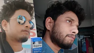 How to grow a beard 100% effective solution | दाढ़ी कैसे बढ़ाएं 100% कारगर उपाय | minoxidil review