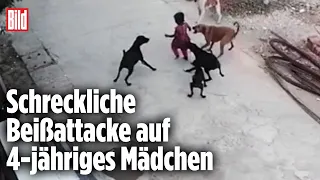 Kleines Mädchen erleidet schwere Verletzungen nach Hundeangriff