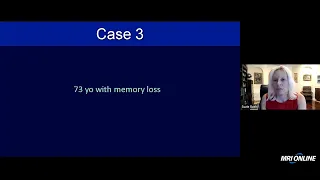 Advanced Dementia Imaging (MRI, AI, & PET)