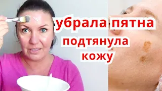 ЧУДО МАСКА  от пигментных пятен/ Отбеливание кожи и подтяжка лица