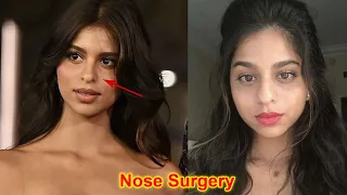 Shahrukh Khan Daughter Suhana Khan Nose and Face Surgery Before her Bollywood Debut