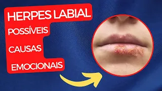 HERPES LABIAL: POSSÍVEIS CAUSAS EMOCIONAIS