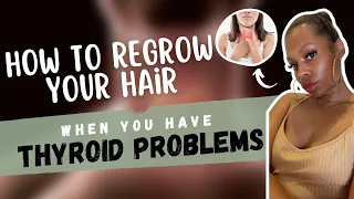 How to Regrow Your Hair When You Have a Thyroid Problem?