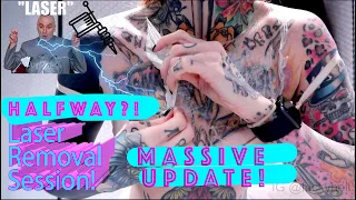 Laser Tattoo removal update!