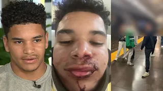 Teen says he was attacked by group inside Kenmore Station after Red Sox game