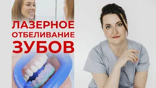 Отбеливание зубов #2 / Как отбеливают зубы? Процесс лазерного отбеливания зубов