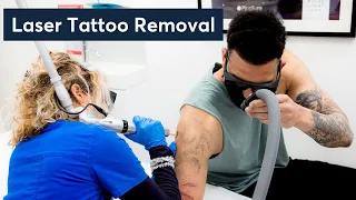 London's Top Clinic Reveals Quick Tattoo Removal Secrets!