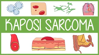 Kaposi Sarcoma in 3 Minutes