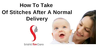 How To Take Care Of Stitches After Delivery