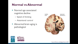 Understanding the Aging Brain — Professional Caregiver Webinar