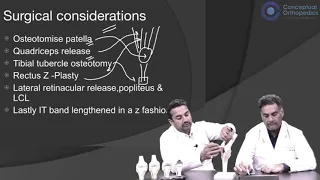 Total Knee Replacement In Stiff Knee 🦵  Watch And Learn From Best @ConceptualOrthopedics