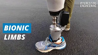 Bionics are the future of prosthetics