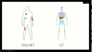 Pet TC - Imagem Oncológica (CASO CLÍNICO)